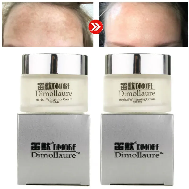 Dimollaure Whitening Face Cream Moisturizing Freckle Melasma Remove Brown Dark Spots Pigment Melanin Brighten Facial Skin Care