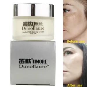Dimollaure Whitening Face Cream Moisturizing Freckle Melasma Remove Brown Dark Spots Pigment Melanin Brighten Facial Skin Care