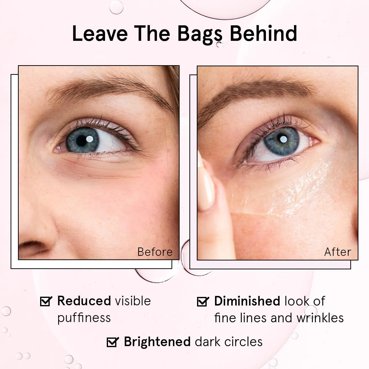 under Eye Brightener Roller - Retinol & Caffeine Eye Serum for Puffiness, Dark Circles, Fine Lines & Wrinkles - Hydrating & Smoothing - Vegan Cruelty-Free Skincare (15Ml / 0.51 Fl Oz)
